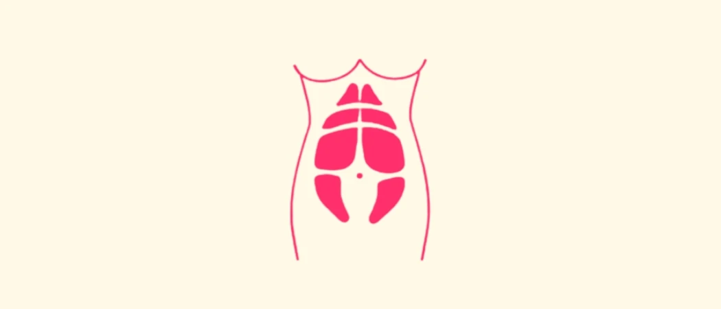 Say Goodbye to Diastasis Recti
