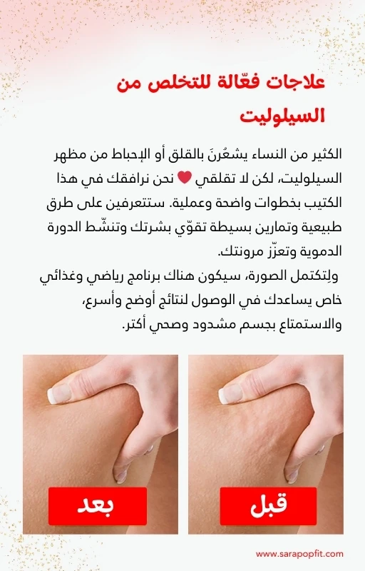 دليلك للتعرف على السيلوليت والوذمة الشحمية والتخلص منهما