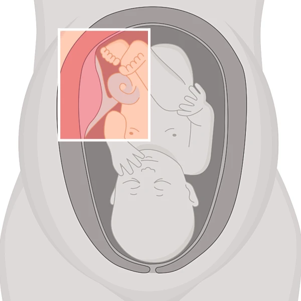 Placenta | Natural Skin Treatment